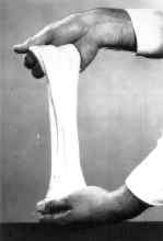 Gluten gives dough its elasticity.